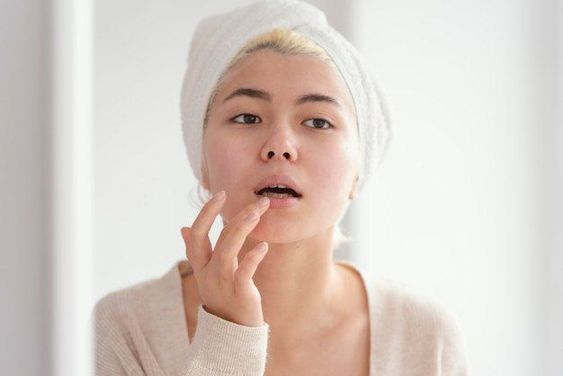 Bibir Kering? Ini Dia 9 Cara Efektif Yang Bisa Kamu Coba untuk Menjaga Kelembapan Bibir